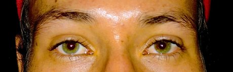 Alan Meyer_ perfekte schöne galerien