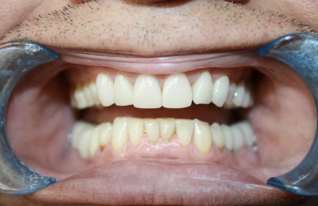 ToothFetish Doc pornographische bild