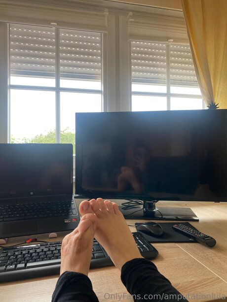 Amputationlula nackt porno galerien