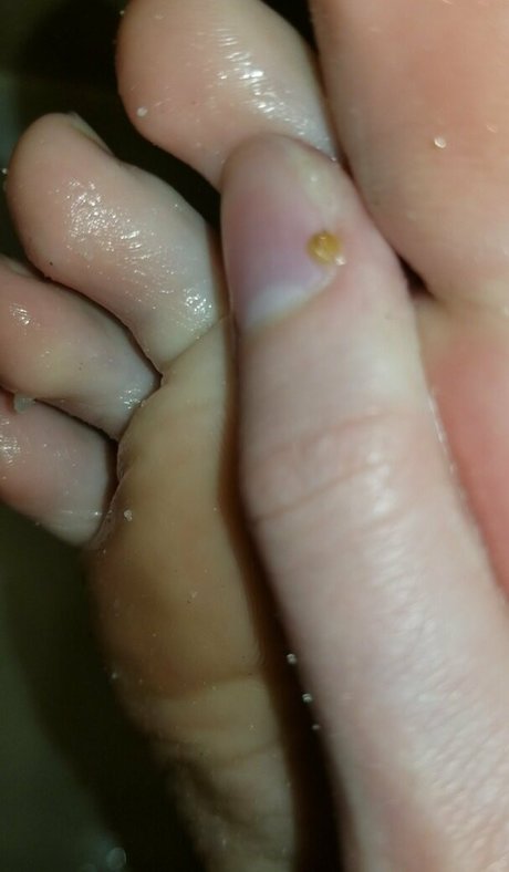 doveylovesfeet nackt beste foto