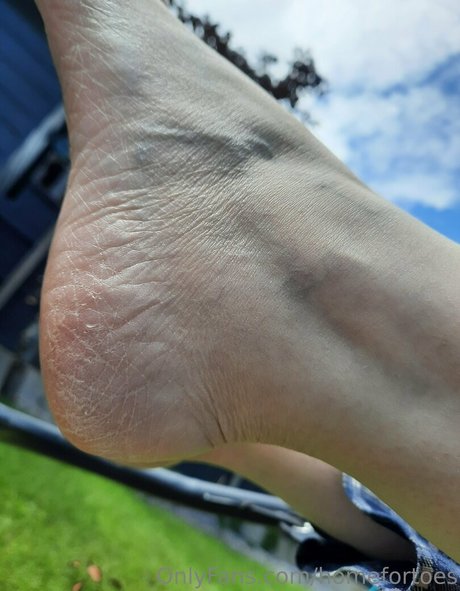 homefortoes nackt hd bild