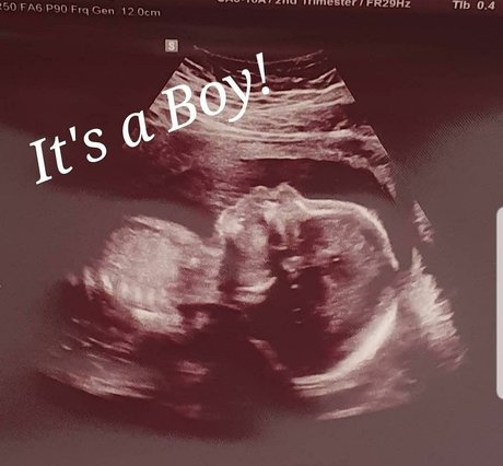 Stephanie Fox xxx fotos