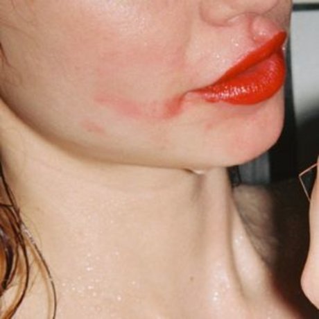 Herbert Twins xxx kostenlose archiv