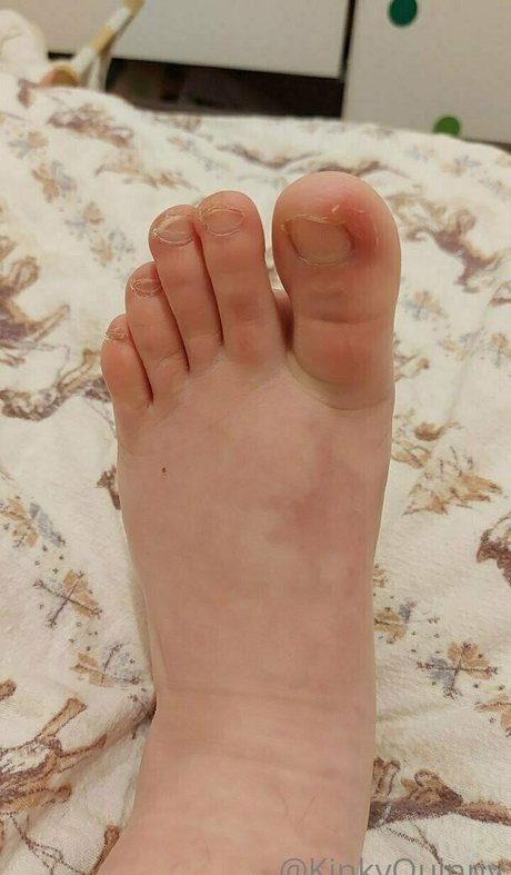 kinkyquinny top hübsche galerie