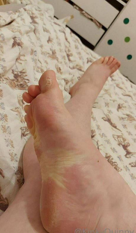 kinkyquinny pornographische galerien