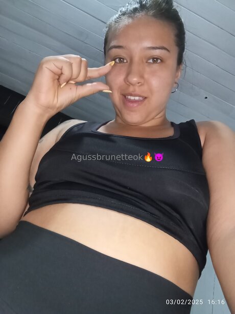 braces onlyfans perfect gallery