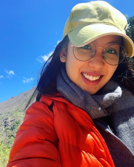 bald pussy onlyfans best pic