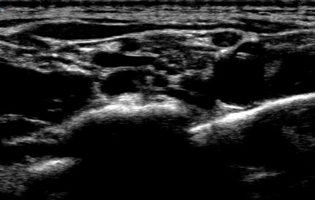 blonde teen pussy onlyfans hot sex img