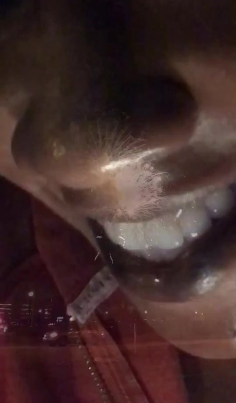 braces onlyfans top galleries
