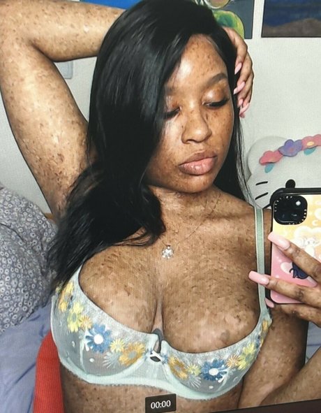 freckledn star nice photo