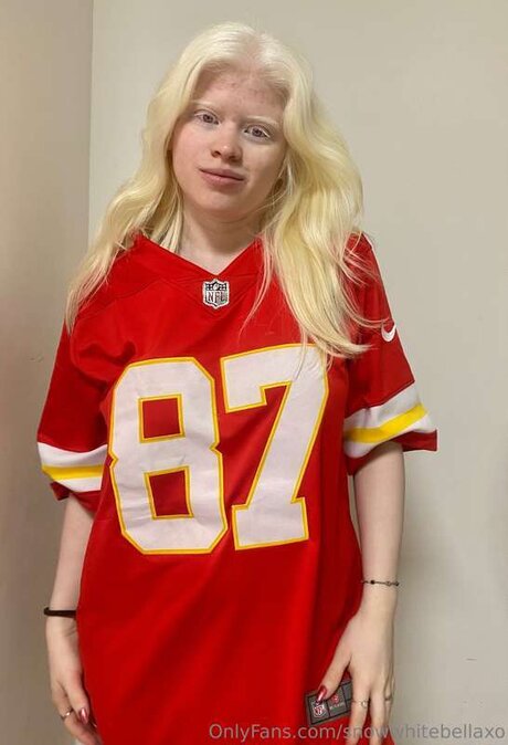 Snowwhitebellaxo model hot picture