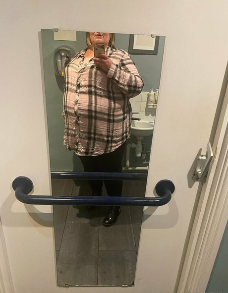 braces onlyfans pretty image