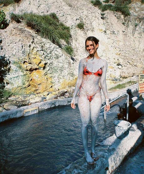 braces onlyfans exclusive images