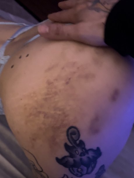 Birth defect model xxx archive