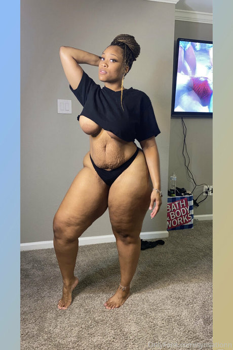 Synsationn トップスター ギャラリー