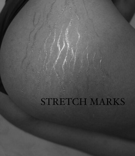 ホットなティーンオンリーファン セクシー 写真