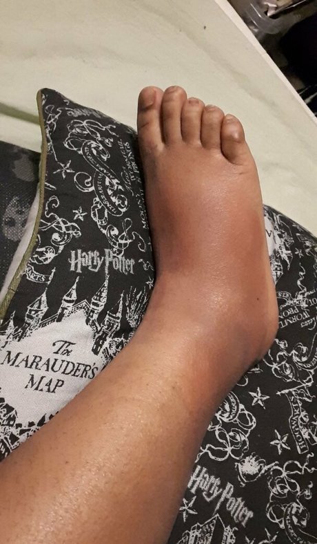 sillytilly 素敵なスター 写真