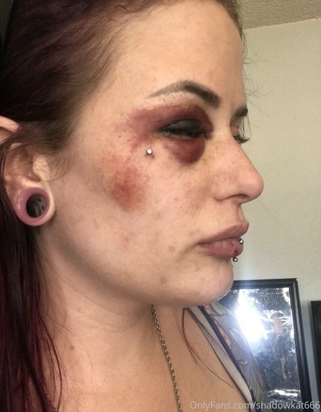 shadowkat666 xxx nacktheit fotos