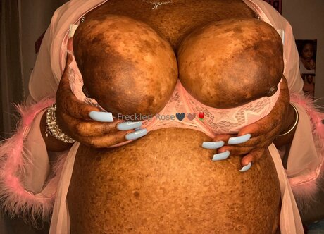 Freckledfantasy5 beste schöne bild