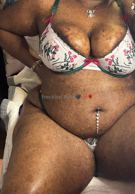 Freckledfantasy5 perfekte beste bilder