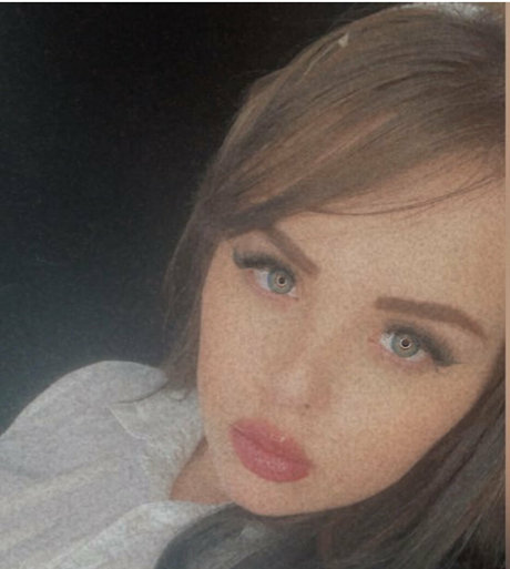 haarige mädchen nur fans freie nacktheit archiv