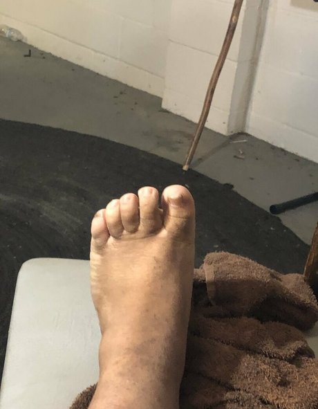 cherrykoolaid erotische nackten fotos