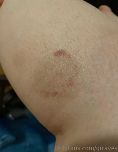 grraves schöne pornographische galerie