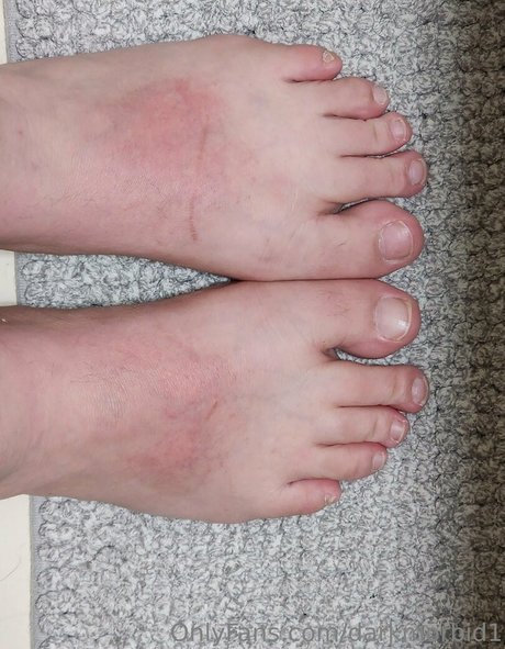 darkmorbid1 nackt hübsche foto