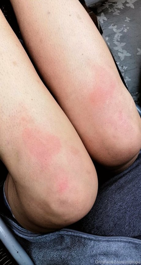 antilopa hübsche freie galerien