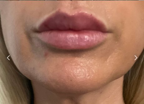 Nipsstrips hübsche foto