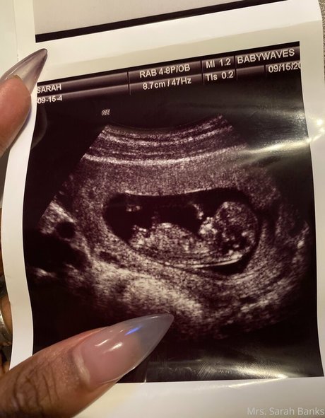 thesarahbnkx erwachsene kostenlose archiv