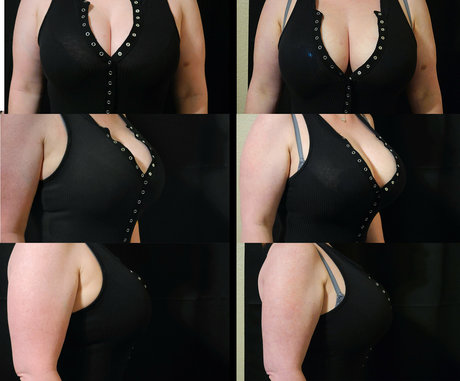 dennadoll hübsche akt galerien