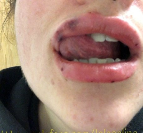 teen anal onlyfans erwachsene sexy fotos