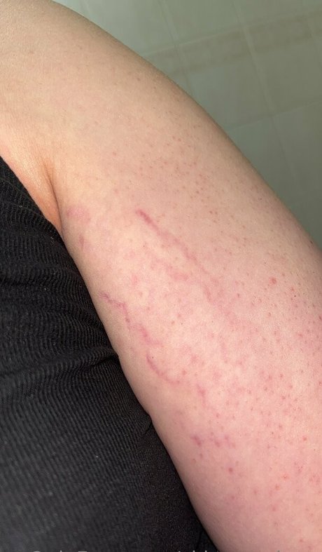 skinny twiggy heiße erwachsene galerien